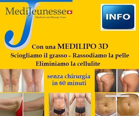 MEDILIPO : LA LIPOSCULTURA LASER A FIBRA OTTICA - MEDI JEUNESSE CLINIC